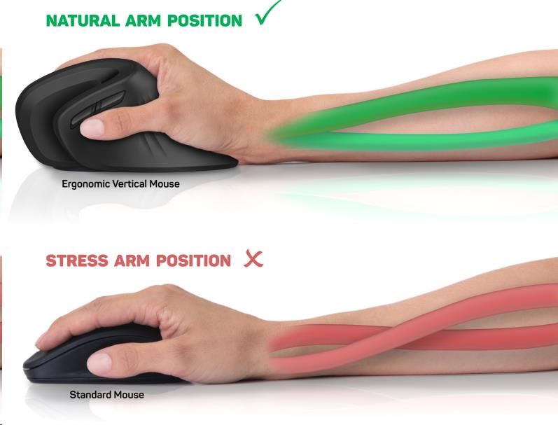 CONNECT IT FOR HEALTH Ergonomická vertikálna myš (+ 1x batéria AA zdarma) bezdrôtová,  čierna9 